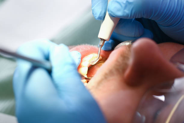 Best Pediatric Emergency Dentist in Indian Hills, TX